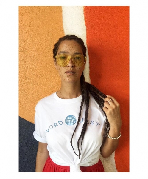 9 моделей с нестандартной внешностью, которые «взорвали» подиумы