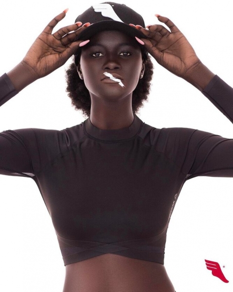 9 моделей с нестандартной внешностью, которые «взорвали» подиумы