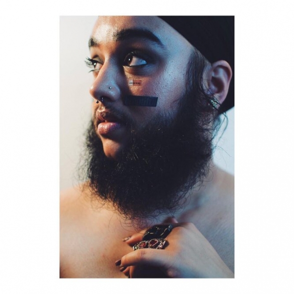 9 моделей с нестандартной внешностью, которые «взорвали» подиумы