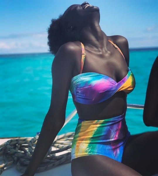 9 моделей с нестандартной внешностью, которые «взорвали» подиумы