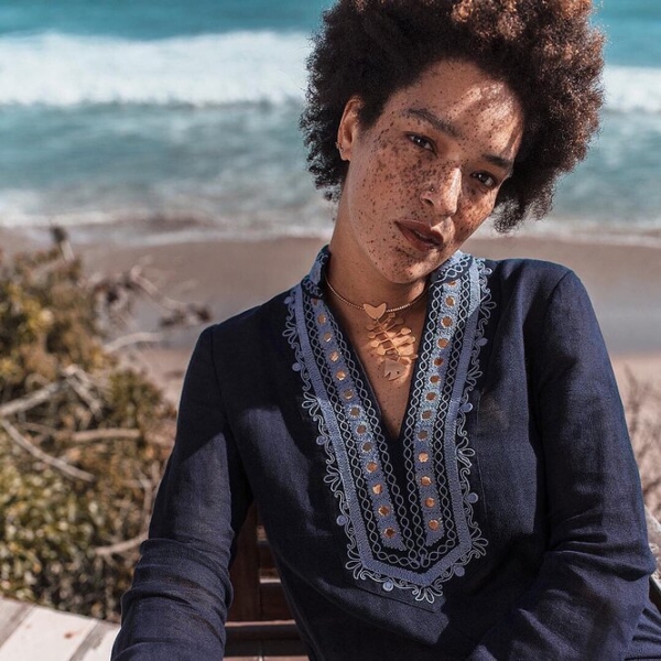 9 моделей с нестандартной внешностью, которые «взорвали» подиумы