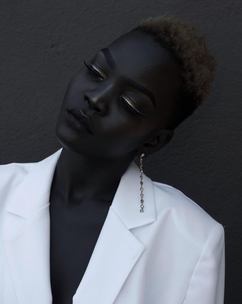 9 моделей с нестандартной внешностью, которые «взорвали» подиумы