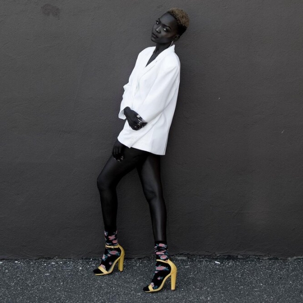 9 моделей с нестандартной внешностью, которые «взорвали» подиумы