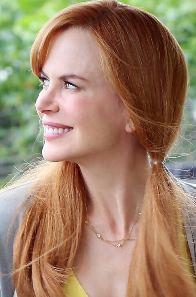 Белее белого: звезды, которые решили проблему желтых зубов с помощью виниров