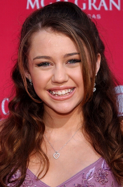 Белее белого: звезды, которые решили проблему желтых зубов с помощью виниров