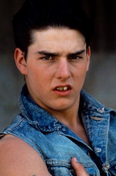 Белее белого: звезды, которые решили проблему желтых зубов с помощью виниров