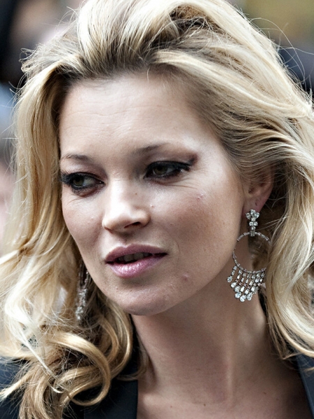 Ничего не помогает? 10 звезд, которые борются с проблемной кожей