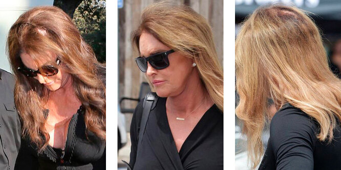 Они их теряют: звезды, которые лысеют из-за постоянных экспериментов с волосами