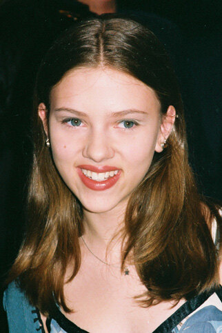 Остались с носом: звезды, изменившие лицо ринопластикой