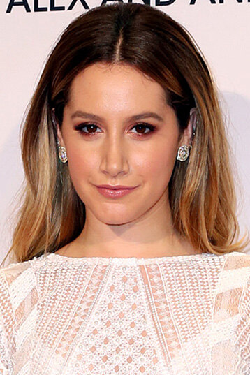 Остались с носом: звезды, изменившие лицо ринопластикой