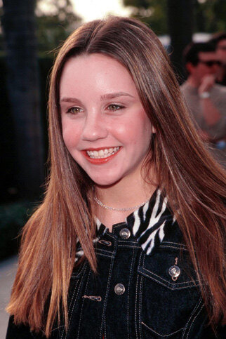 Остались с носом: звезды, изменившие лицо ринопластикой