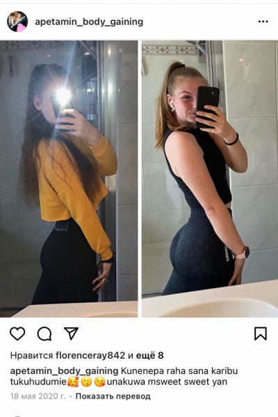 Отказ печени и&nbsp;кома: к&nbsp;чему приводит прием средства для&nbsp;увеличения ягодиц