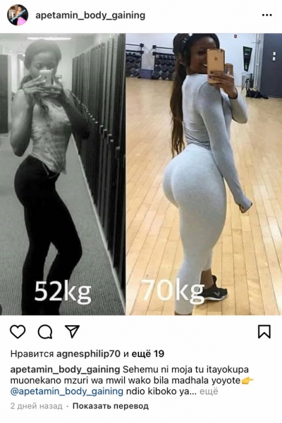 Отказ печени и&nbsp;кома: к&nbsp;чему приводит прием средства для&nbsp;увеличения ягодиц