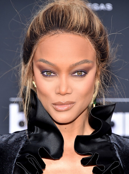 Памела Андерсон и&nbsp;другие звезды с&nbsp;узкими глазами после неудачной блефаропластики