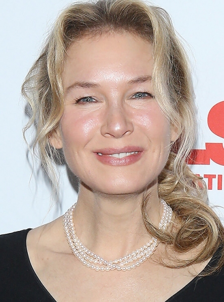 Памела Андерсон и&nbsp;другие звезды с&nbsp;узкими глазами после неудачной блефаропластики