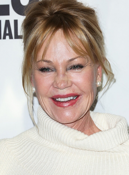 Памела Андерсон и&nbsp;другие звезды с&nbsp;узкими глазами после неудачной блефаропластики