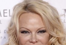 Памела Андерсон и другие звезды с узкими глазами после неудачной блефаропластики