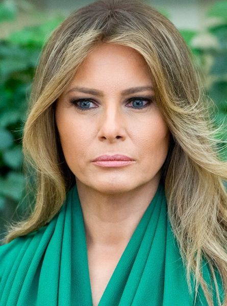 Памела Андерсон и&nbsp;другие звезды с&nbsp;узкими глазами после неудачной блефаропластики