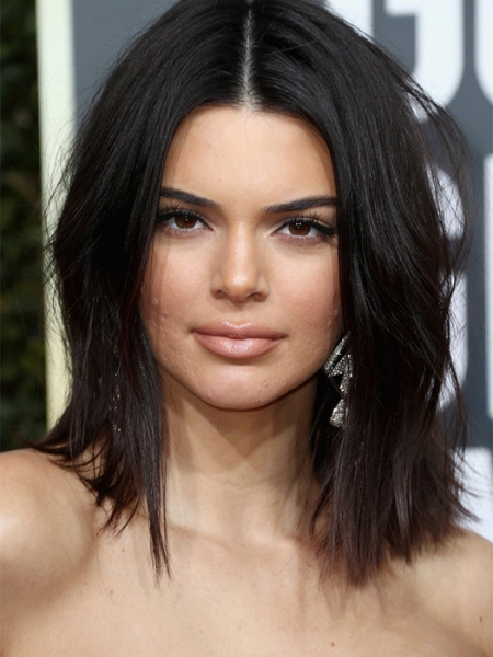 По стопам Кендалл Дженнер: причины и лечение акне во взрослом возрасте