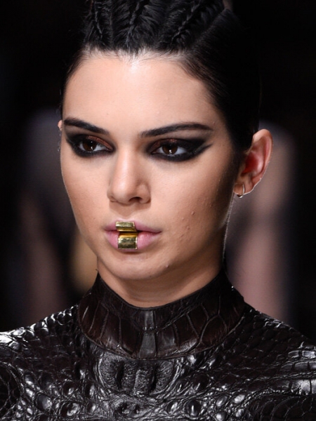 По стопам Кендалл Дженнер: причины и лечение акне во взрослом возрасте