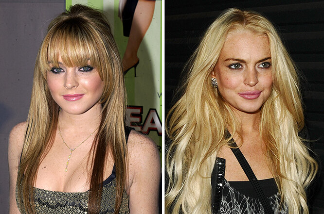 Пухлые губы без&nbsp;филлеров: что такое булхорн и&nbsp;кто из&nbsp;звезд уже сделал операцию