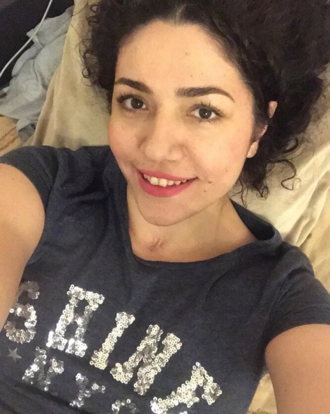 Такие еще остались? Звезды «Дома-2», которые не делали пластику