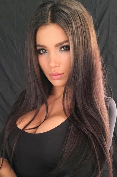 Ты их не&nbsp;узнаешь! 12 звезд инстаграма до&nbsp;и после пластики