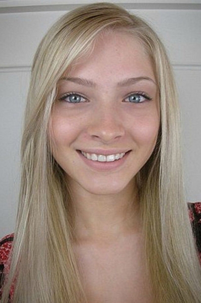 Ты их не&nbsp;узнаешь! 12 звезд инстаграма до&nbsp;и после пластики