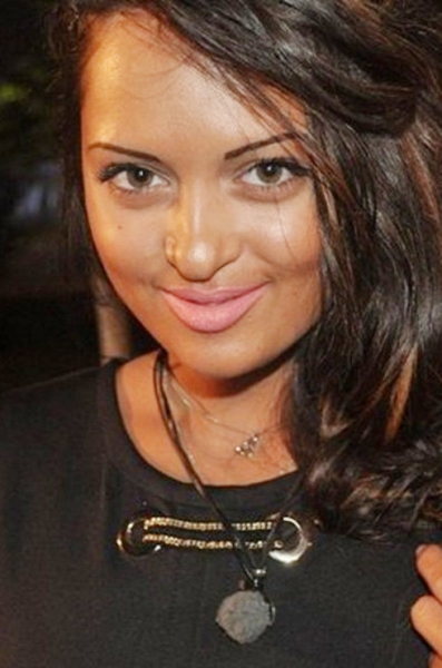 Ты их не&nbsp;узнаешь! 12 звезд инстаграма до&nbsp;и после пластики