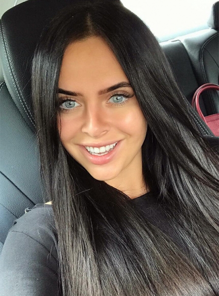 Улыбка за миллион: сколько звезды заплатили за свои идеальные зубы