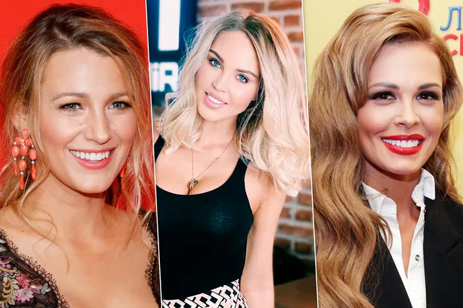 Улыбка за миллион: сколько звезды заплатили за свои идеальные зубы