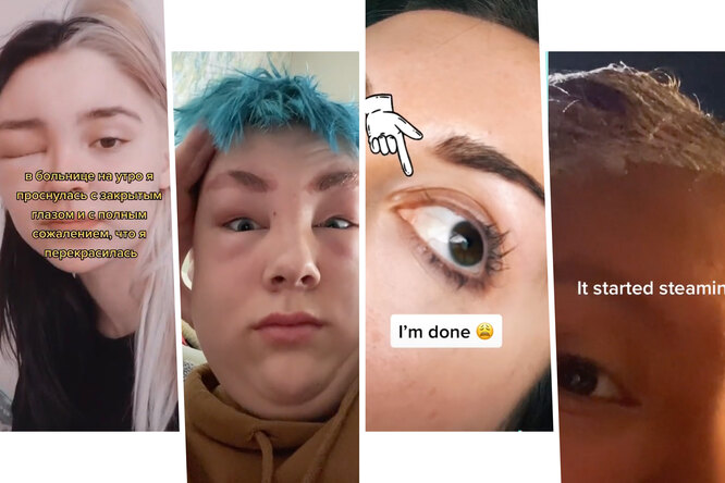 Загорелись волосы, выпали ресницы: домашние процедуры, которые пошли не&nbsp;по плану