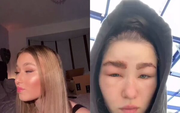 Загорелись волосы, выпали ресницы: домашние процедуры, которые пошли не&nbsp;по плану