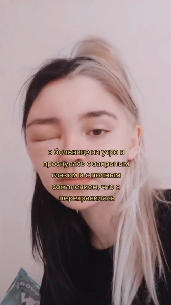 Загорелись волосы, выпали ресницы: домашние процедуры, которые пошли не&nbsp;по плану