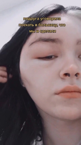 Загорелись волосы, выпали ресницы: домашние процедуры, которые пошли не&nbsp;по плану