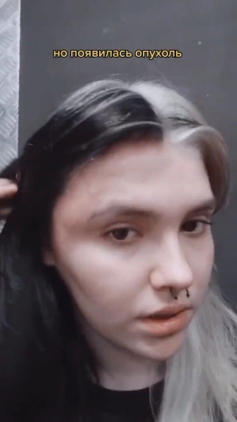 Загорелись волосы, выпали ресницы: домашние процедуры, которые пошли не&nbsp;по плану