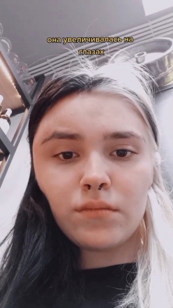 Загорелись волосы, выпали ресницы: домашние процедуры, которые пошли не&nbsp;по плану