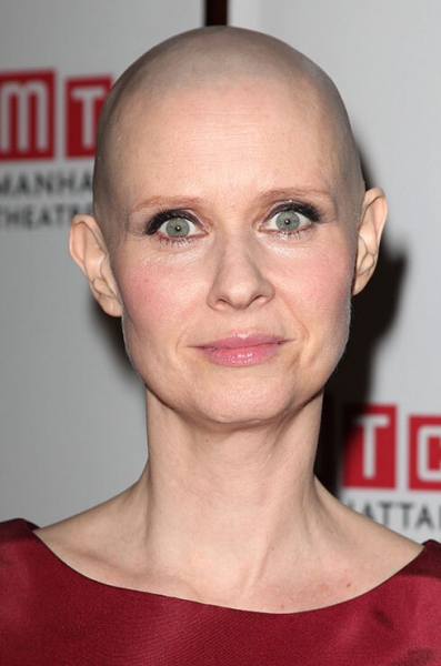 А ей идет! Стюарт и другие звёзды, которым лысина к лицу