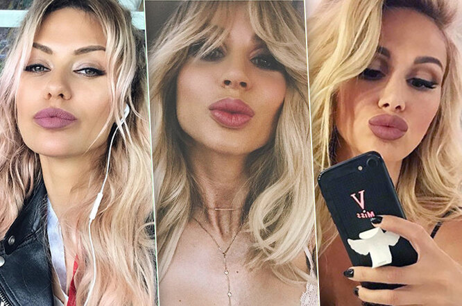 Атака клонов: эти звезды так увлеклись «тюнингом», что стали похожи