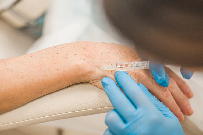 Что такое биоревитализация: всё, что нужно знать о процедуре