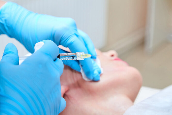 Что такое биоревитализация: всё, что нужно знать о процедуре