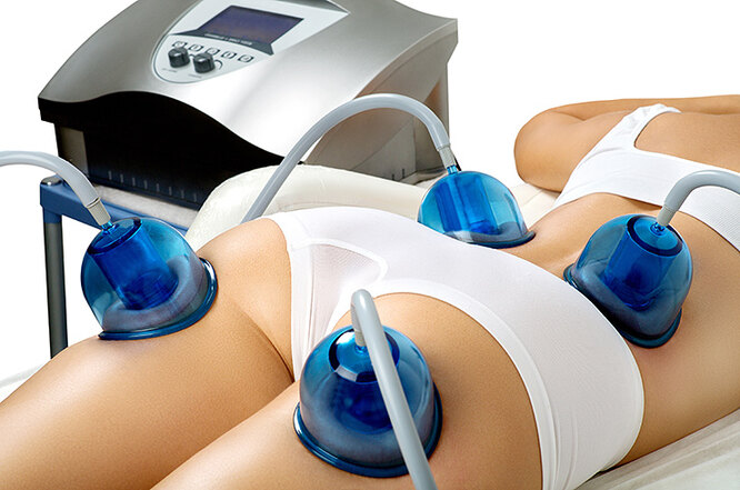 Дешево и&nbsp;эффективно: 5 средств от&nbsp;целлюлита, которые ты легко сделаешь сама