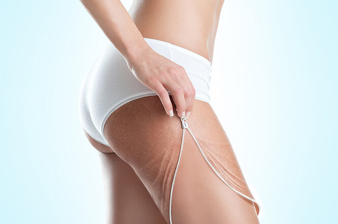 Дешево и&nbsp;эффективно: 5 средств от&nbsp;целлюлита, которые ты легко сделаешь сама