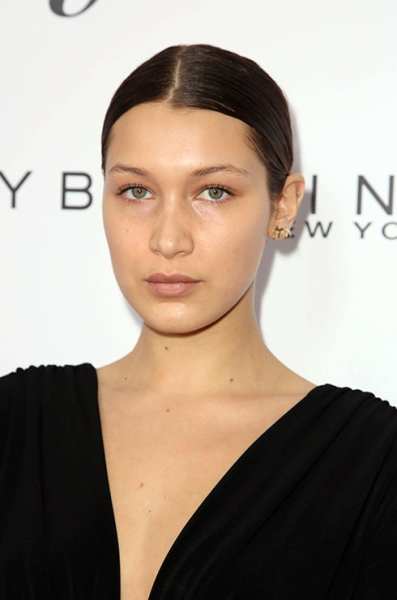 Экс-простушки: 10 звезд с ювелирной пластикой — до и после