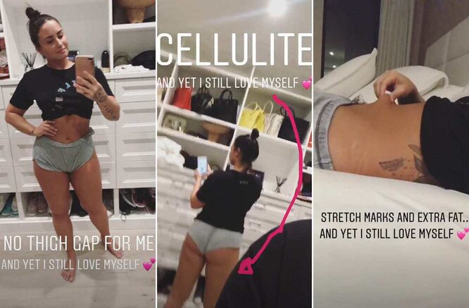 Эшли Грэм и другие звезды, которые не стесняются своего целлюлита и растяжек