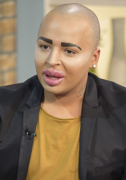 Фанаты, которые изуродовали себя, чтобы стать похожими на кумиров