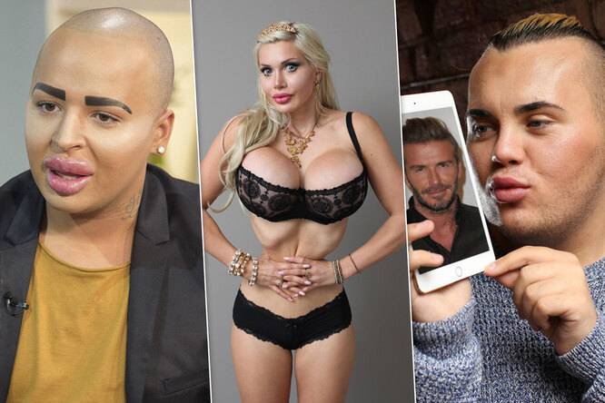 Фанаты, которые изуродовали себя, чтобы стать похожими на кумиров