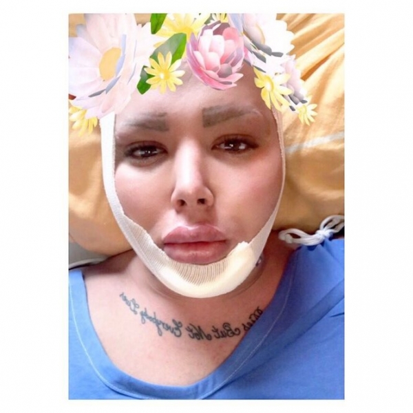 Фанаты, которые изуродовали себя, чтобы стать похожими на кумиров