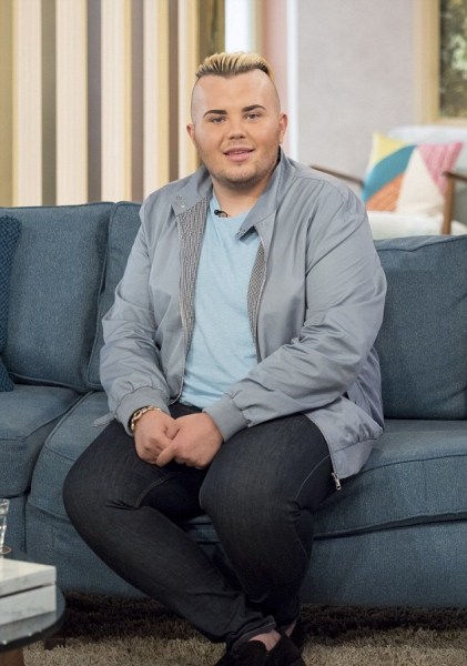 Фанаты, которые изуродовали себя, чтобы стать похожими на кумиров