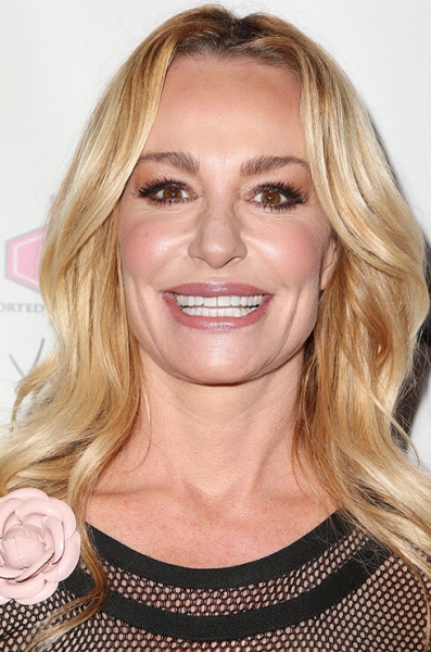 Хочется и колется: как не потерять лицо после инъекций красоты